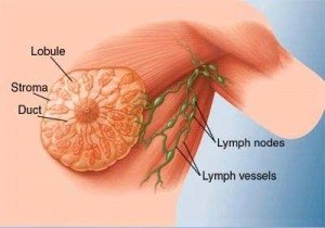 Schematic of Lymph Vessels (www.mayoclinic.com)